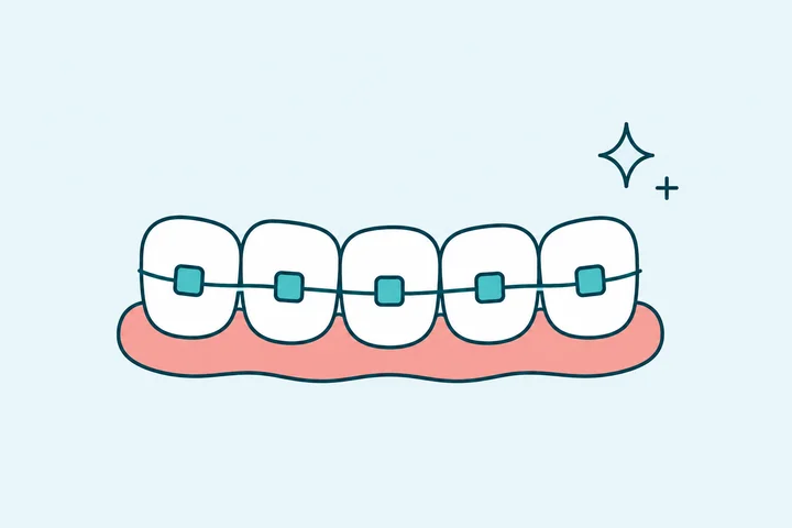 Pendakap Gigi & Clear Aligners