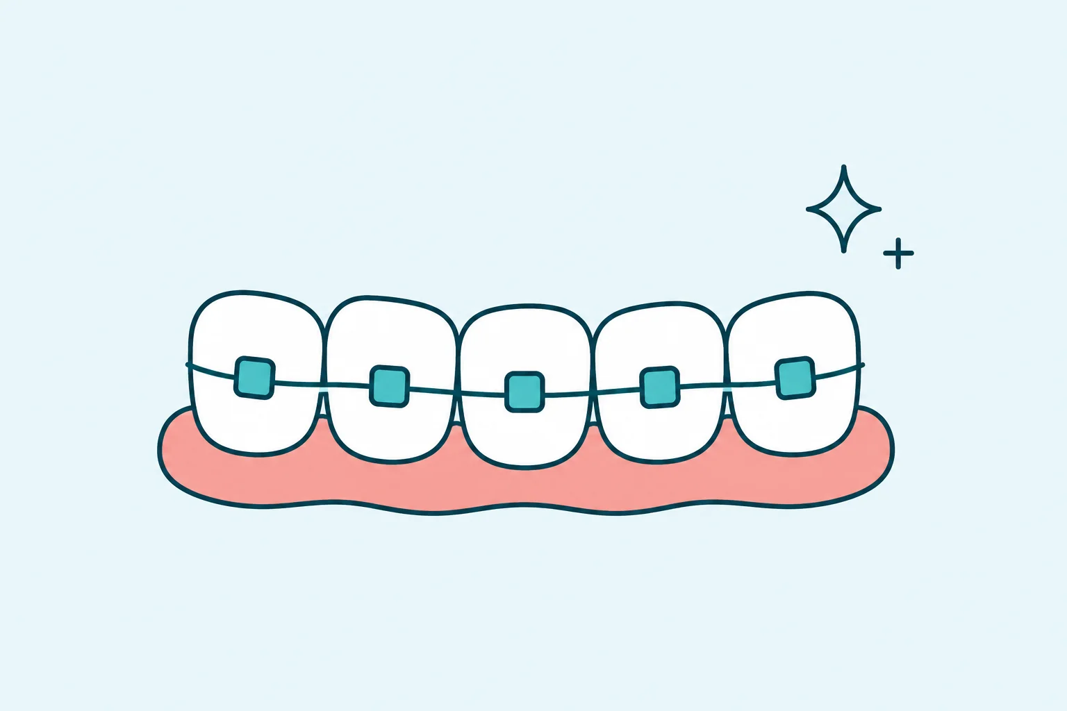 Braces & Aligners