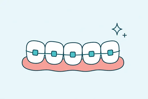 Pendakap Gigi & Clear Aligners