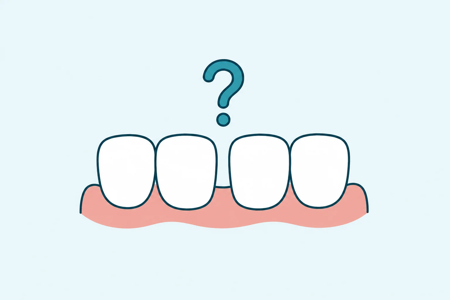 How to Close a Gap Between Front Teeth: Braces, Aligners, Bonding or Veneers?