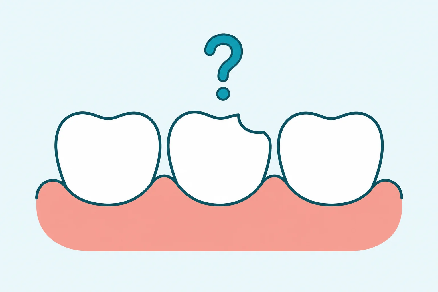 What Happens If You Don't Replace a Missing Tooth?