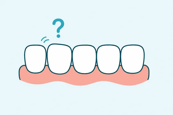 Do Teeth Shift Back After Braces? Retainers and Why They Matter