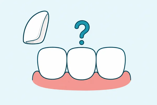 Do Veneers Ruin Your Real Teeth? What Actually Happens Underneath