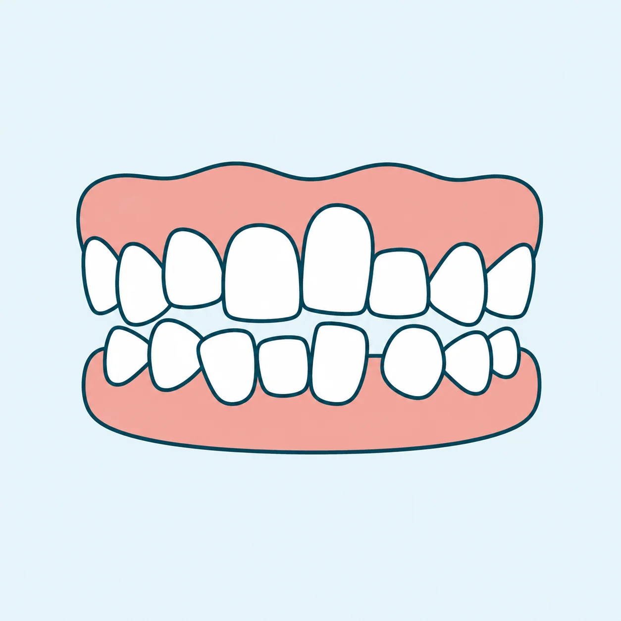 Generally Uneven Teeth