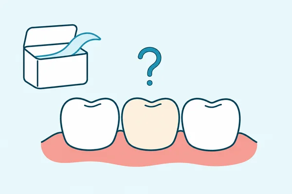 Professional Whitening vs Whitening Strips and LED Kits: What's the Real Difference?