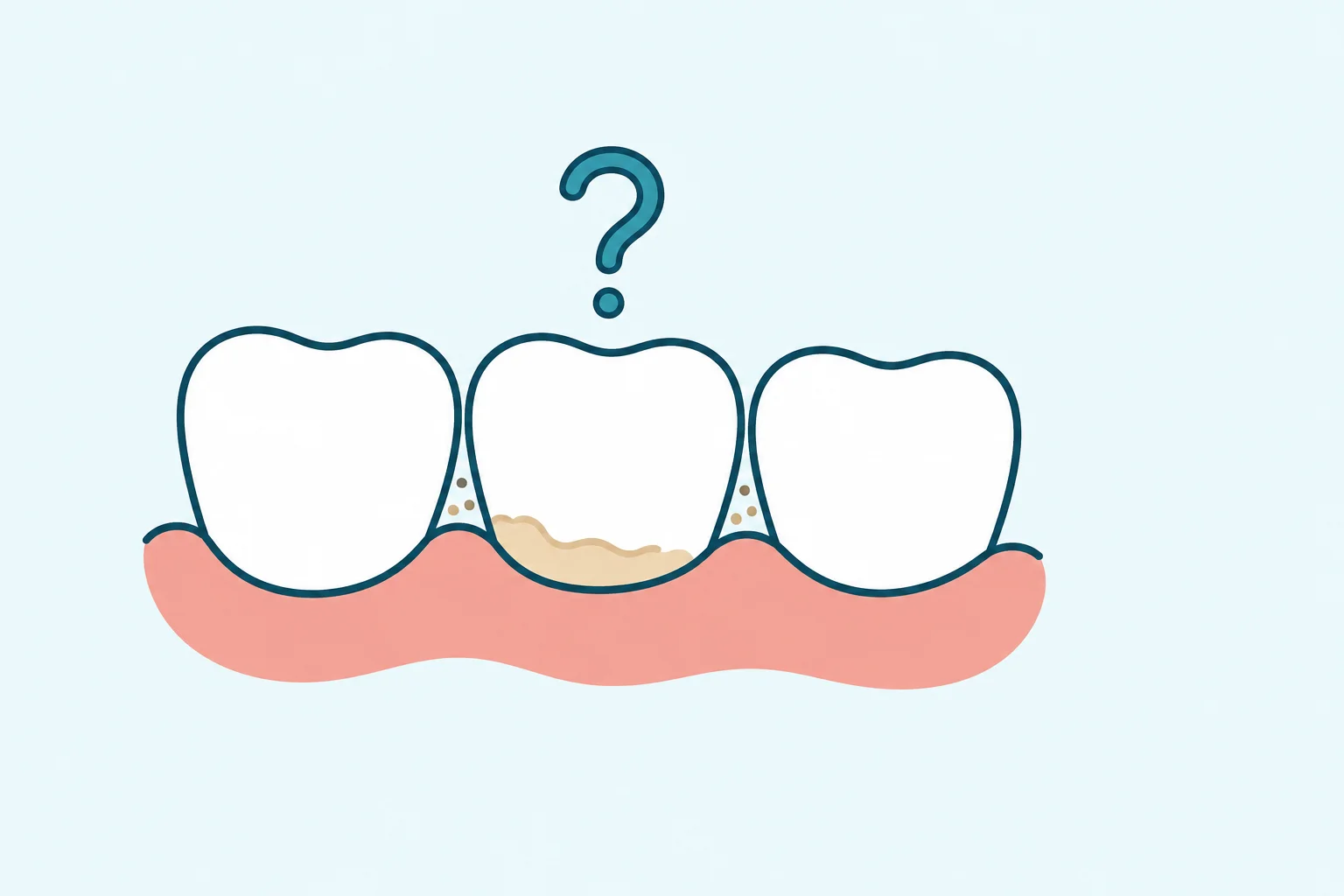 What Is Tartar, and Can You Remove It Yourself?
