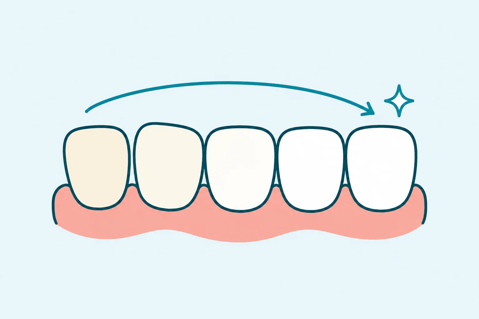 Smile Makeover