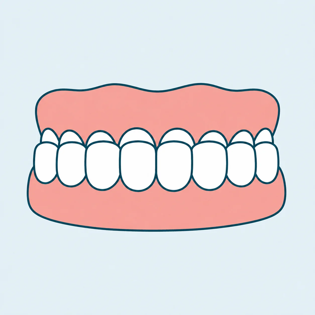 Underbite