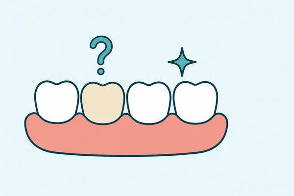 Why Whitening Doesn't Work on Some Teeth (Crowns, Fillings and Grey Stains)
