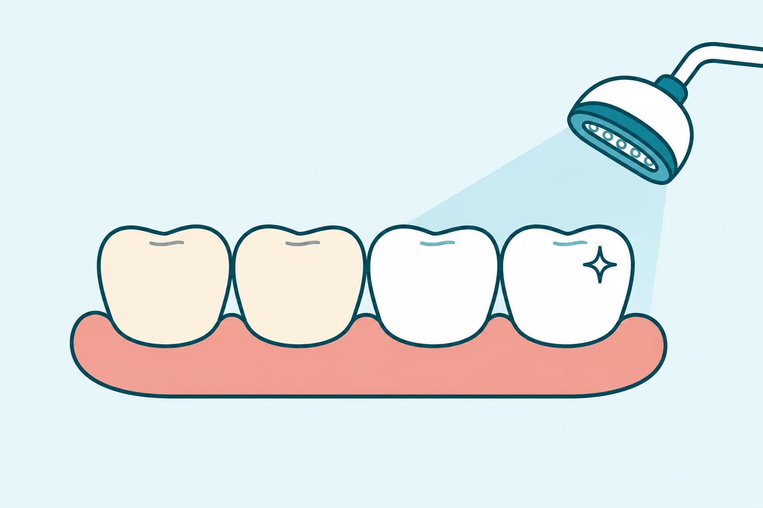 Teeth Whitening